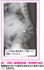 Spine