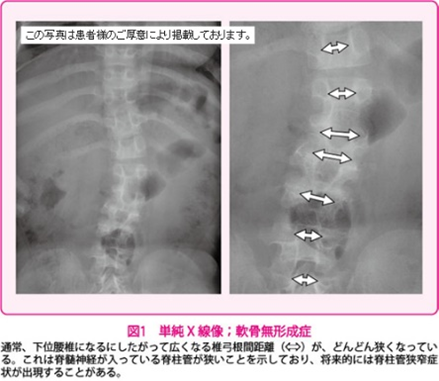 sugical-spine