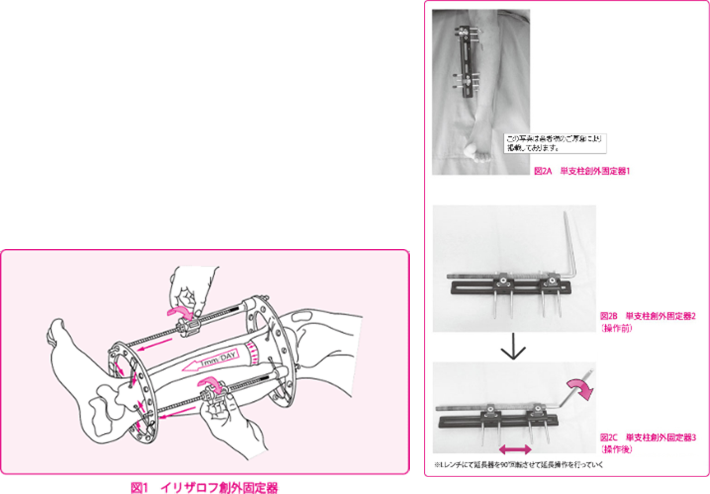 surgical-treatment-of-lower-limb-upper-limb