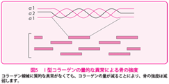 the-osteogenesis-imperfecta-4